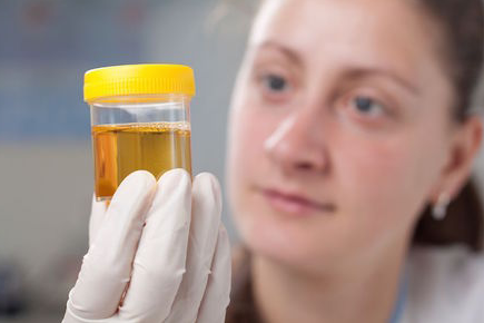 Synthetic Urine Testing for Truckers